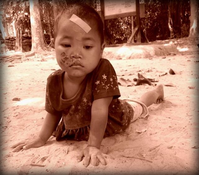 A young child playing on the beachfront in Thailand with evidence of previous "rough n tumble" antics